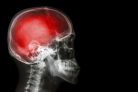 Czy sartany cechują się właściwościami neuroprotekcyjnymi?