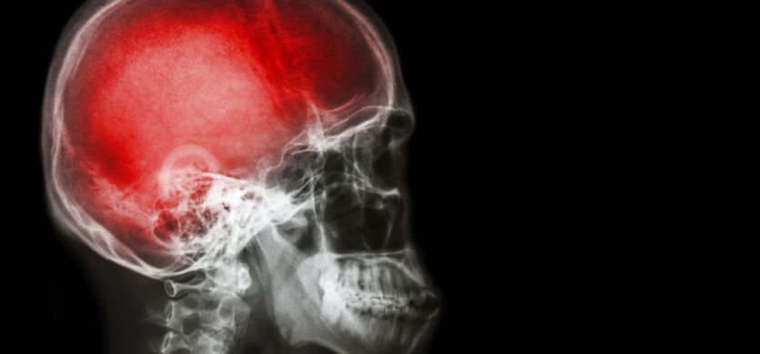 Czy sartany cechują się właściwościami neuroprotekcyjnymi?