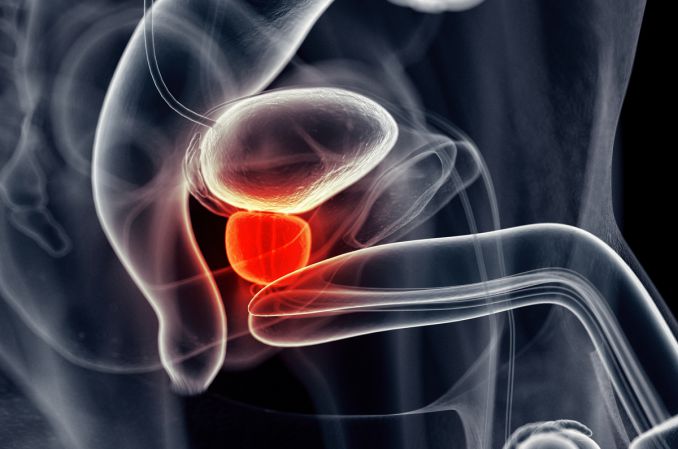 Co roku w Polsce na raka prostaty umiera 5,5 tys. mężczyzn