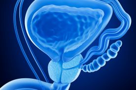 Badanie śliny pozwala ocenić ryzyko raka prostaty lepiej niż test PSA z krwi